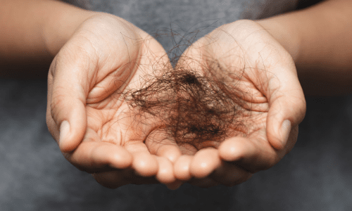 human hair in hands due to hair loss