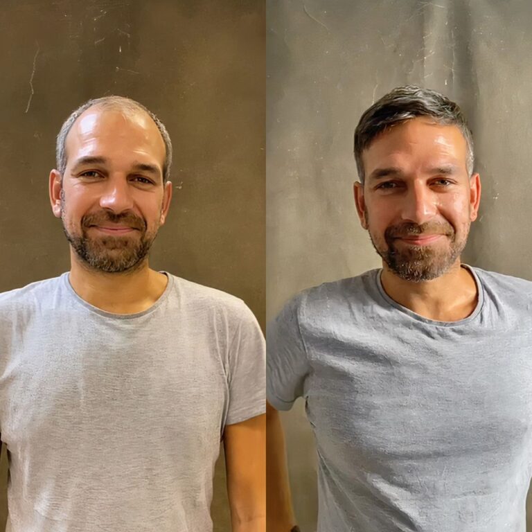 mens hair system