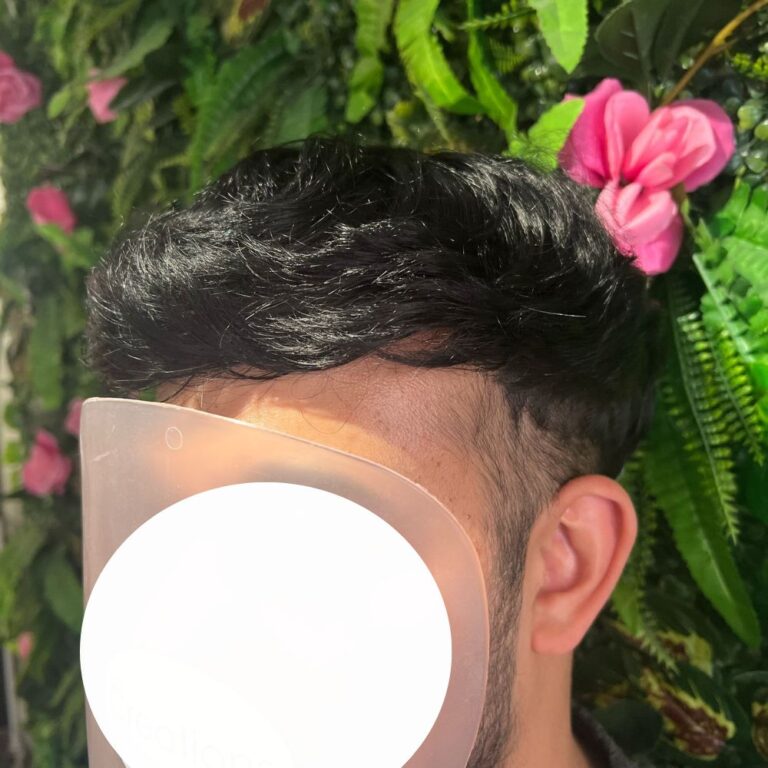 mens hair system