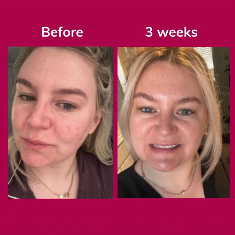 Before and after glowwa